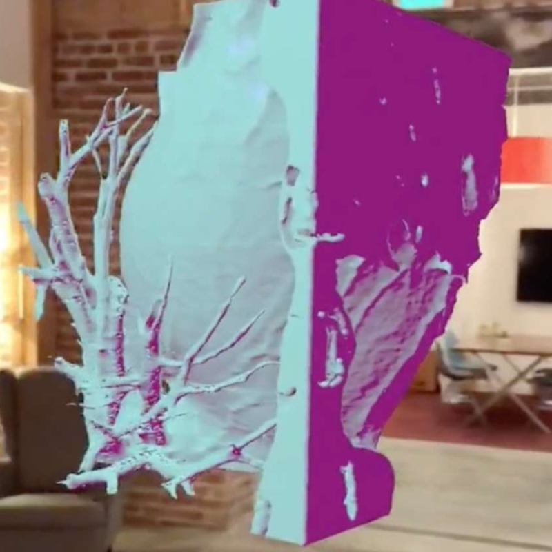 AR Heart Scan